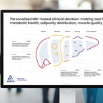 AMRA Medical at AASLD 2022: Premier MRI Technology and Informatics for The Full Continuum of Liver Disease