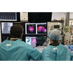 Successful First-in-Human Clinical Study of Kardium’s Next Generation Globe® Pulsed Field System