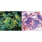 Aquyre Biosciences Reaches Major Procedure Milestone During Lung Awareness Month