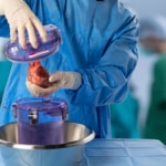 Clinical Evidence Shows Reduced Costs and Improved Outcomes in Heart Transplantation