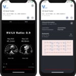 Viz.ai Launches AI-Powered VizTM Cardio Suite