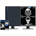 Viz.ai Launches AI-powered Viz™ Radiology Suite
