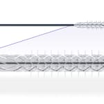 First Patient Enrolled in Reflow Medical’s DEEPER REVEAL IDE Clinical Study